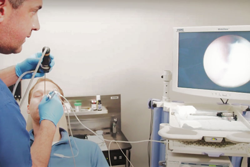 Male doctor inserts scope into patient’s nose while viewing camera feed on a screen to his right